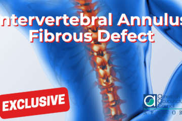 Intervertebral Annulus Fibrous Defect