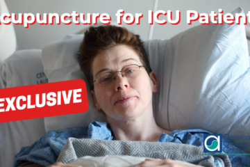 Acupuncture for ICU Patients