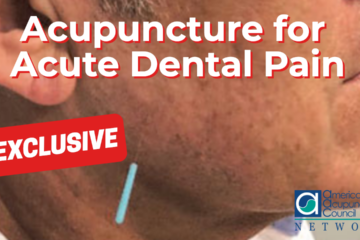 Acupuncture for Acute Dental Pain