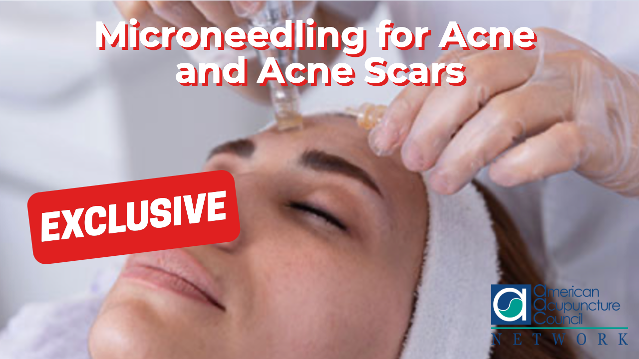 Microneedling for Acne and Acne Scars